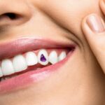 The New Trend? Why Celebrities Are Embracing Dental Bling
