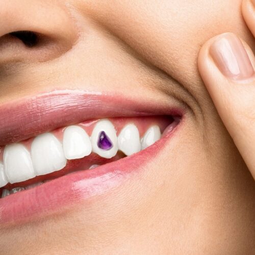 tooth jewelry