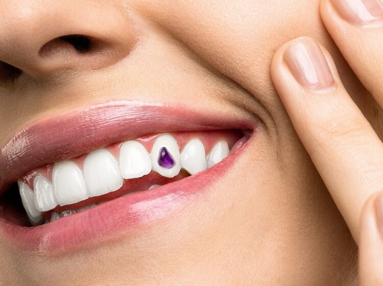 tooth jewelry
