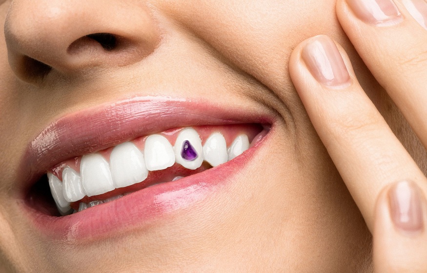 tooth jewelry